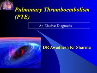 Pulmonary Thromboembolism
(PTE)
        An Elusive Diagnosis




          DR Awadhesh Kr Sharma
 