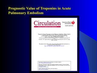 Prognostic Value of Troponins in Acute
Pulmonary Embolism
 
