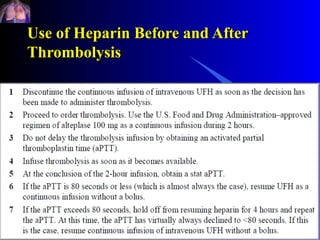 Use of Heparin Before and After
Thrombolysis
 