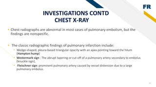 Pulmonary Embolism FINAL 2.pptx