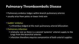 Pulmonary Thromboembolic Disease
• Pulmonary embolus lodges within branch pulmonary arteries
• usually arise from pelvic or lower limb vein
• Saddle’ embolus
• a thrombus lodged at the main pulmonary arterial bifurcation
• Pulmonary infarction
• relatively rare as there is a second ‘systemic’ arterial supply to the
lungs from the bronchial arteries
• Infarction therefore requires compromise of both arterial supplies
 
