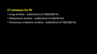 CT windows for PE
• Lung window - width/level of 1500/600 HU
• Mediastinal window - width/level of 400/40 HU
• Pulmonary embolism window - width/level of 700/100 HU
 