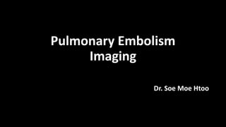Pulmonary Embolism
Imaging
Dr. Soe Moe Htoo
 