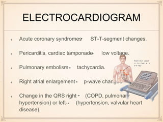 ELECTROCARDIOGRAM
Acute coronary syndromes ST-T-segment changes.
Pericarditis, cardiac tamponade low voltage.
Pulmonary embolism tachycardia.
Right atrial enlargement p-wave changes
Change in the QRS right (COPD, pulmonary
hypertension) or left (hypertension, valvular heart
disease).
 