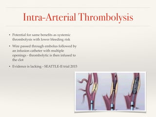 Intra-Arterial Thrombolysis
• Potential for same beneﬁts as systemic
thrombolysis with lower bleeding risk
• Wire passed through embolus followed by
an infusion catheter with multiple
openings - thrombolytic is then infused to
the clot
• Evidence is lacking - SEATTLE-II trial 2015
 