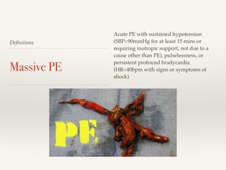 Deﬁnitions
Massive PE
Acute PE with sustained hypotension
(SBP<90mmHg for at least 15 mins or
requiring inotropic support, not due to a
cause other than PE), pulselessness, or
persistent profound bradycardia
(HR<40bpm with signs or symptoms of
shock)
 