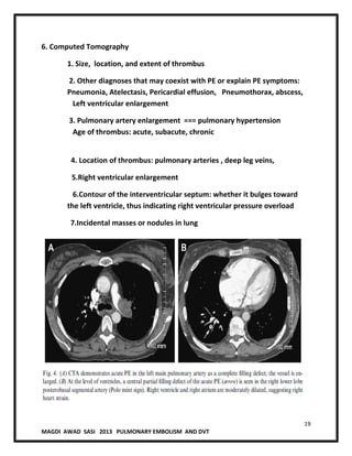 19
MAGDI AWAD SASI 2013 PULMONARY EMBOLISM AND DVT
6. Computed Tomography
1. Size, location, and extent of thrombus
2. Other diagnoses that may coexist with PE or explain PE symptoms:
Pneumonia, Atelectasis, Pericardial effusion, Pneumothorax, abscess,
Left ventricular enlargement
3. Pulmonary artery enlargement === pulmonary hypertension
Age of thrombus: acute, subacute, chronic
4. Location of thrombus: pulmonary arteries , deep leg veins,
5.Right ventricular enlargement
6.Contour of the interventricular septum: whether it bulges toward
the left ventricle, thus indicating right ventricular pressure overload
7.Incidental masses or nodules in lung
 
