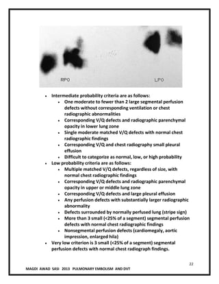 22
MAGDI AWAD SASI 2013 PULMONARY EMBOLISM AND DVT
Intermediate probability criteria are as follows:
One moderate to fewer than 2 large segmental perfusion
defects without corresponding ventilation or chest
radiographic abnormalities
Corresponding V/Q defects and radiographic parenchymal
opacity in lower lung zone
Single moderate matched V/Q defects with normal chest
radiographic findings
Corresponding V/Q and chest radiography small pleural
effusion
Difficult to categorize as normal, low, or high probability
Low probability criteria are as follows:
Multiple matched V/Q defects, regardless of size, with
normal chest radiographic findings
Corresponding V/Q defects and radiographic parenchymal
opacity in upper or middle lung zone
Corresponding V/Q defects and large pleural effusion
Any perfusion defects with substantially larger radiographic
abnormality
Defects surrounded by normally perfused lung (stripe sign)
More than 3 small (<25% of a segment) segmental perfusion
defects with normal chest radiographic findings
Nonsegmental perfusion defects (cardiomegaly, aortic
impression, enlarged hila)
Very low criterion is 3 small (<25% of a segment) segmental
perfusion defects with normal chest radiograph findings.
 