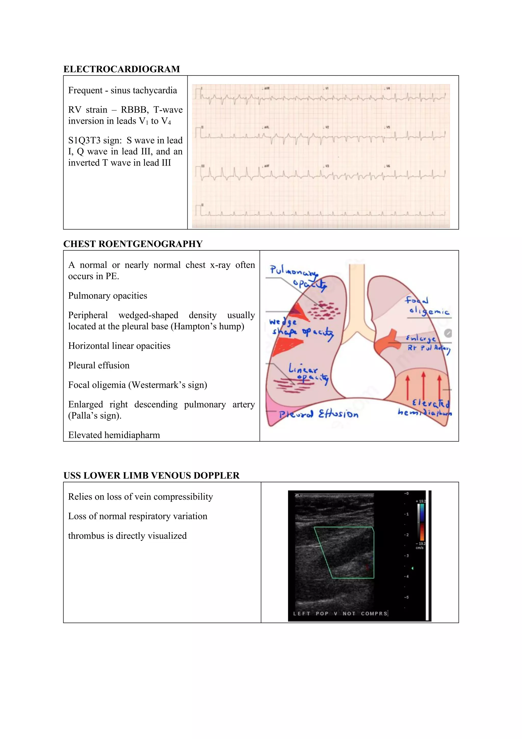ELECTROCARDIOGRAM
Frequent - sinus tachycardia
RV strain – RBBB, T-wave
inversion in leads V1 to V4
S1Q3T3 sign: S wave in lead
I, Q wave in lead III, and an
inverted T wave in lead III
CHEST ROENTGENOGRAPHY
A normal or nearly normal chest x-ray often
occurs in PE.
Pulmonary opacities
Peripheral wedged-shaped density usually
located at the pleural base (Hampton’s hump)
Horizontal linear opacities
Pleural effusion
Focal oligemia (Westermark’s sign)
Enlarged right descending pulmonary artery
(Palla’s sign).
Elevated hemidiapharm
USS LOWER LIMB VENOUS DOPPLER
Relies on loss of vein compressibility
Loss of normal respiratory variation
thrombus is directly visualized
 