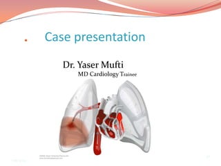    Case presentation
               Dr. Yaser Mufti
                  MD Cardiology Trainee




                                          1/1
7/18/2012
 