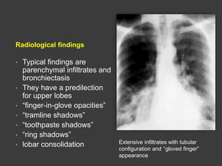 Radiological findings
• Typical findings are
parenchymal infiltrates and
bronchiectasis
• They have a predilection
for upper lobes
• “finger-in-glove opacities”
• “tramline shadows”
• “toothpaste shadows”
• “ring shadows”
• lobar consolidation Extensive infiltrates with tubular
configuration and ‘‘gloved finger”
appearance
 