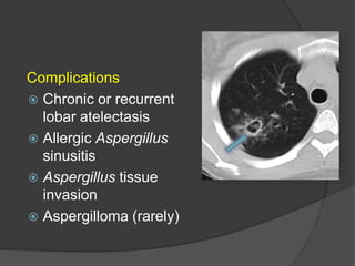 Complications
 Chronic or recurrent
lobar atelectasis
 Allergic Aspergillus
sinusitis
 Aspergillus tissue
invasion
 Aspergilloma (rarely)
 