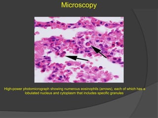High-power photomicrograph showing numerous eosinophils (arrows), each of which has a
lobulated nucleus and cytoplasm that includes specific granules.
Microscopy
 
