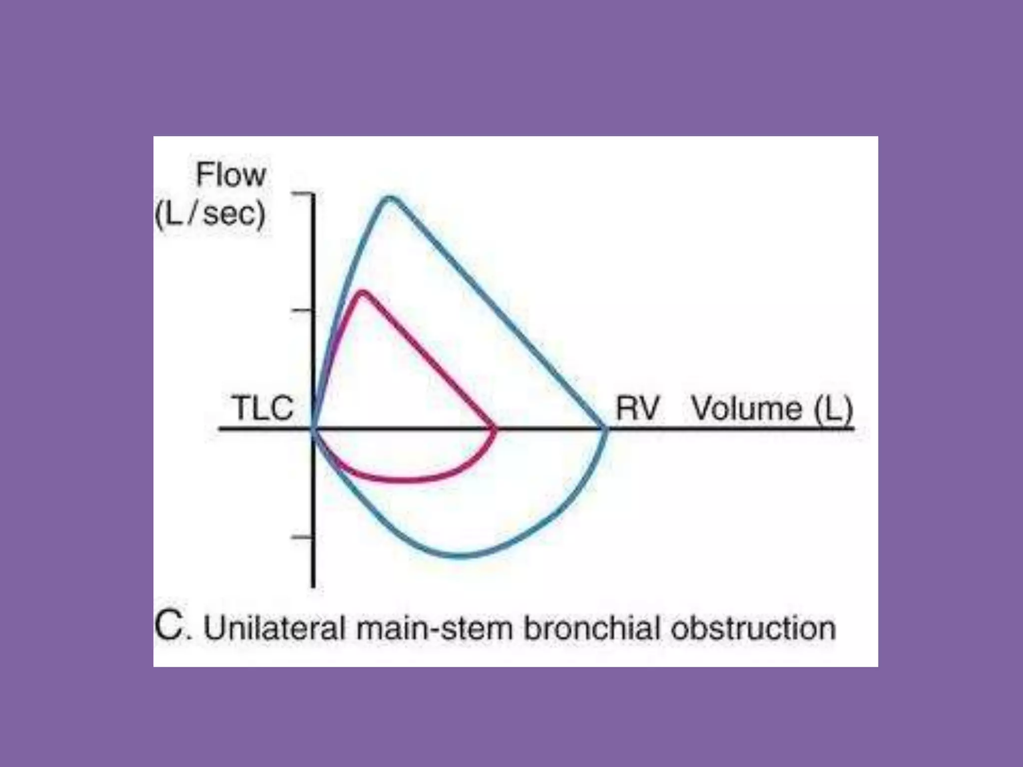 Pulmonary Flow Volume Loops.. Dr.Padmesh PPT