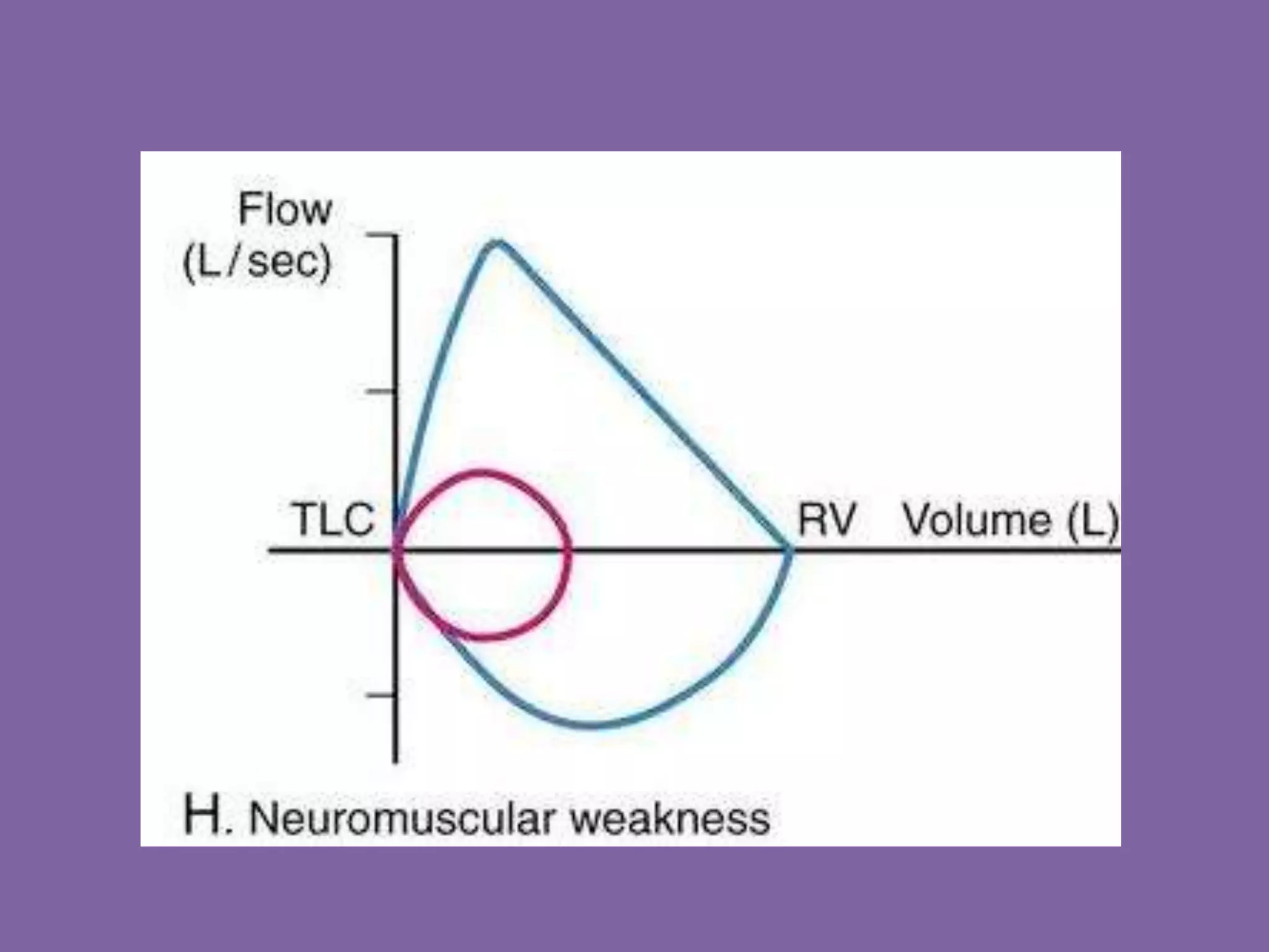 Pulmonary Flow Volume Loops.. Dr.Padmesh PPT