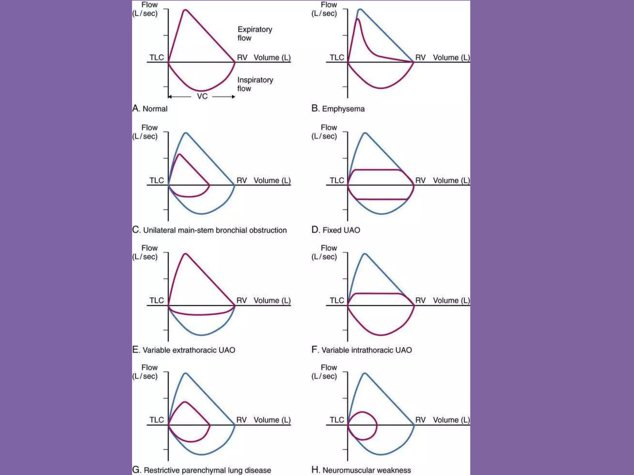 Pulmonary Flow Volume Loops.. Dr.Padmesh | PPTX