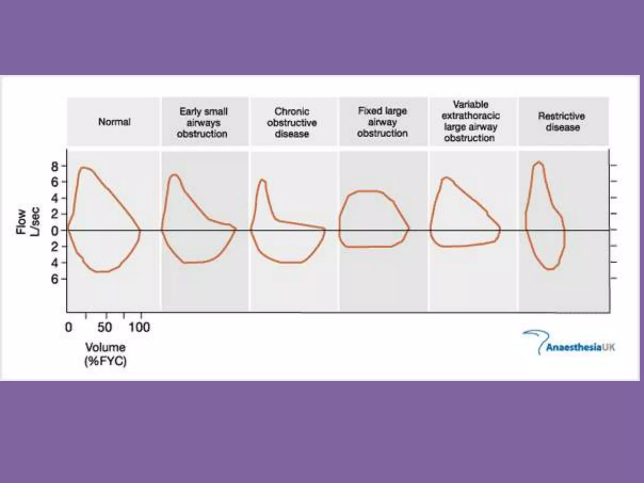 Pulmonary Flow Volume Loops.. Dr.Padmesh PPT