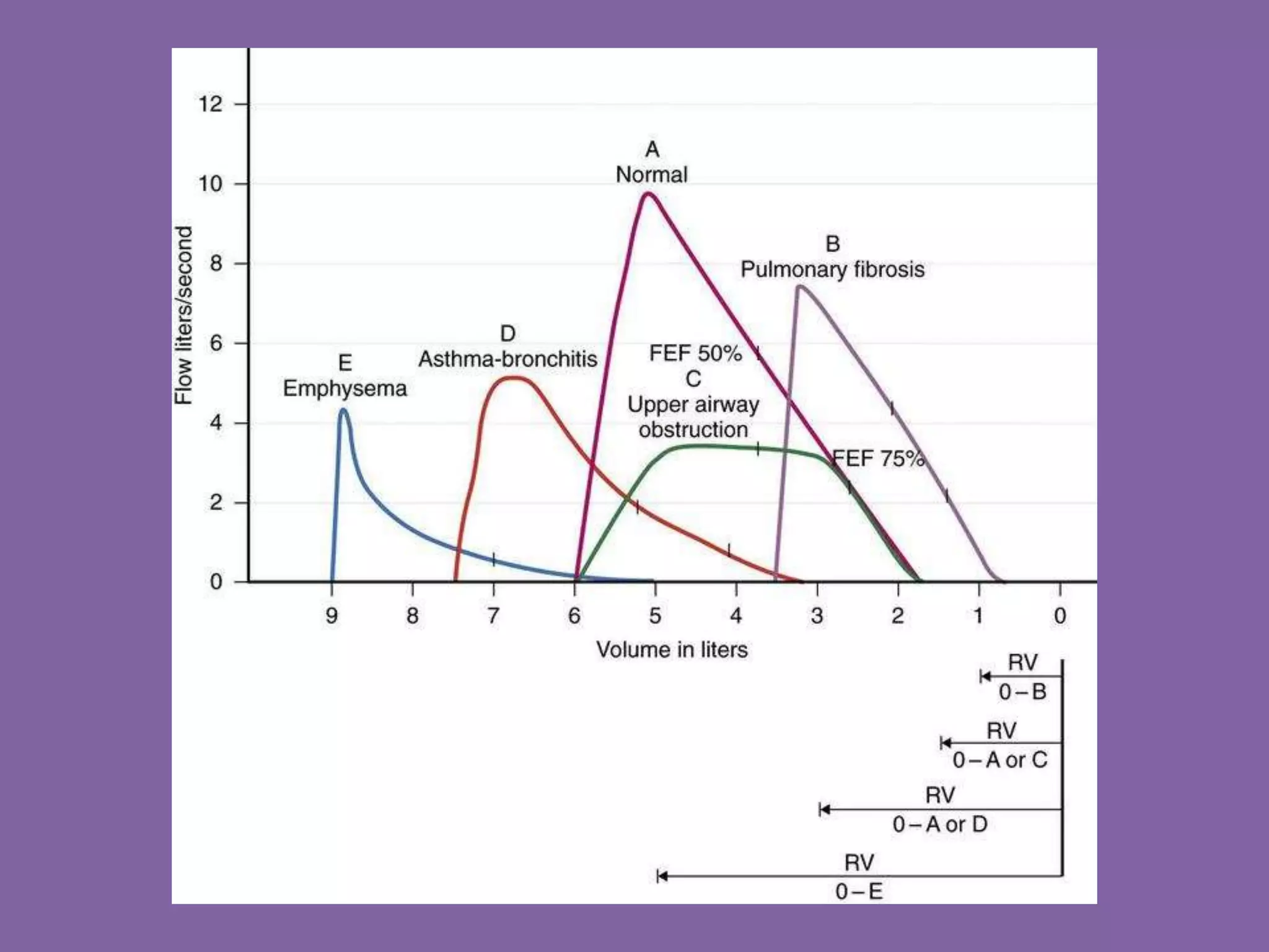 Pulmonary Flow Volume Loops.. Dr.Padmesh PPT