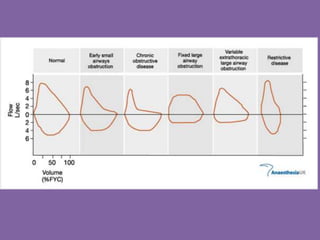 Pulmonary Flow Volume Loops.. Dr.Padmesh | PPTX