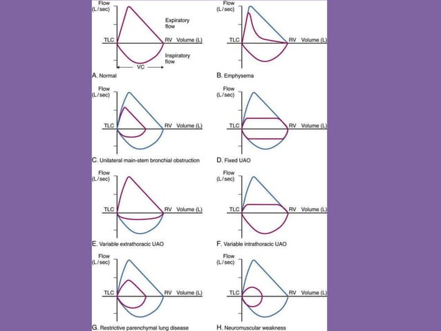 Pulmonary Flow Volume Loops.. Dr.Padmesh