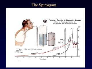 The Spirogram
 