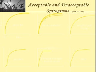 Acceptable and Unacceptable
Spirograms (from ATS, 1994)
c o u g h
0 1
p o o r s ta r t
0
a c tu a l F V C
n o t a t T L C p rio r
to b lo w
0
Volume
T im e
g o o d e ffo rt
0
S u b m a x im a l e ffo rt
0
a c tu a l F V C
p re m a tu re te rm in a tio n
o r g lo ttic c lo s u re
0
 