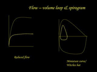 Flow – volume loop & spirogram
Reduced flow
Miniature curve/
Witches hat
 
