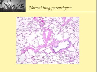 Normal lung parenchyma
 