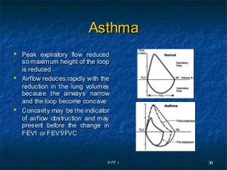 PFT IPFT I 3636
AsthmaAsthma
 Peak expiratory flow reducedPeak expiratory flow reduced
so maximum height of the loopso maximum height of the loop
is reducedis reduced
 Airflow reduces rapidly with theAirflow reduces rapidly with the
reduction in the lung volumesreduction in the lung volumes
because the airways narrowbecause the airways narrow
and the loop become concaveand the loop become concave
 Concavity may be the indicatorConcavity may be the indicator
of airflow obstruction and mayof airflow obstruction and may
present before the change inpresent before the change in
FEV1 or FEV1/FVCFEV1 or FEV1/FVC
 