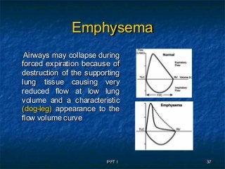 PFT IPFT I 3737
EmphysemaEmphysema
Airways may collapse duringAirways may collapse during
forced expiration because offorced expiration because of
destruction of the supportingdestruction of the supporting
lung tissue causing verylung tissue causing very
reduced flow at low lungreduced flow at low lung
volume and a characteristicvolume and a characteristic
(dog-leg)(dog-leg) appearance to theappearance to the
flow volume curveflow volume curve
 