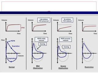 Pulmonary function test | PPTX