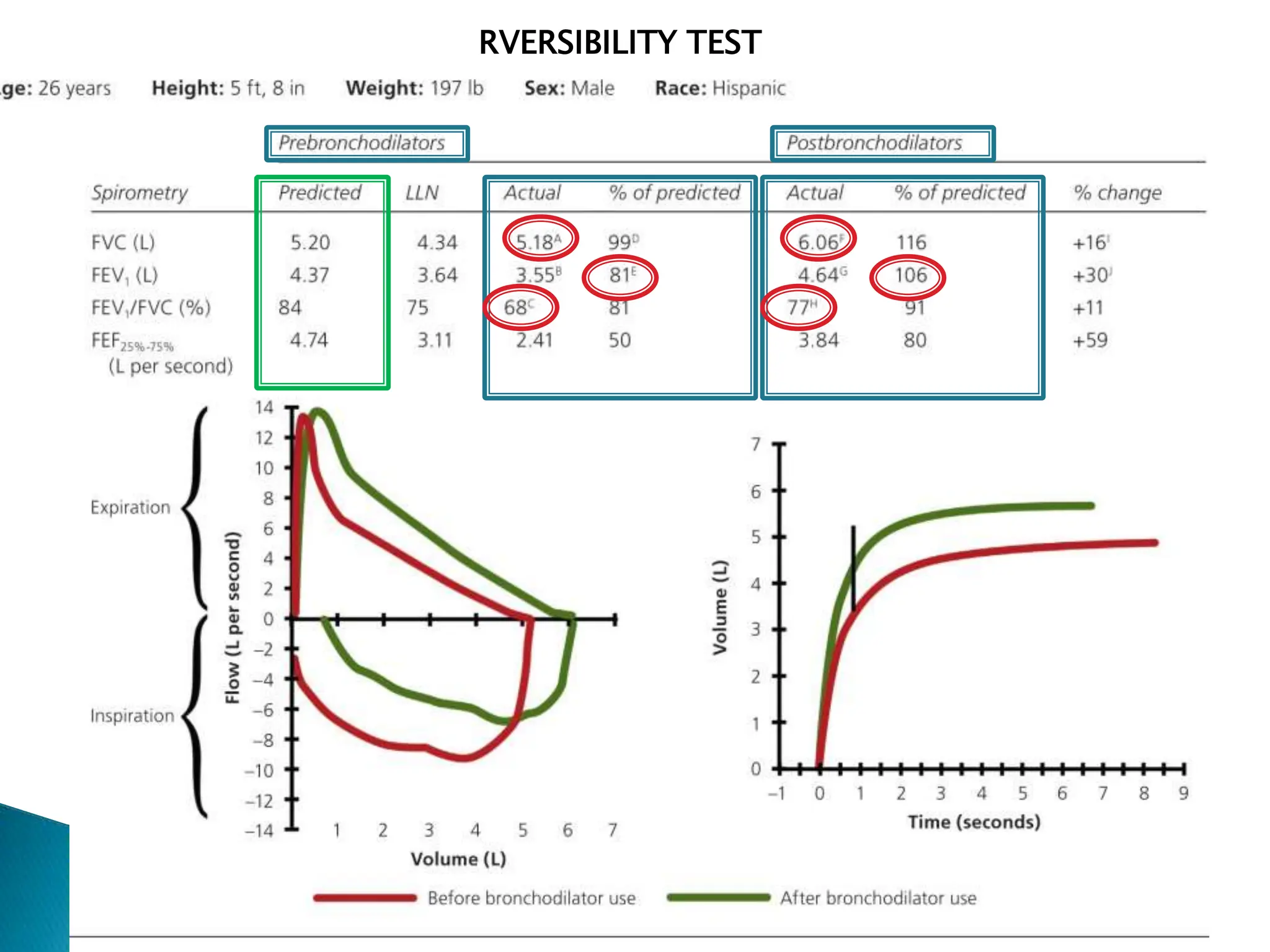 RVERSIBILITY TEST
 