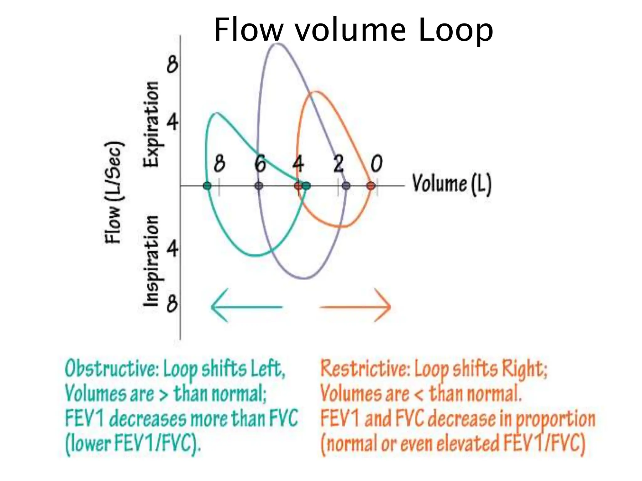 Flow volume Loop
 
