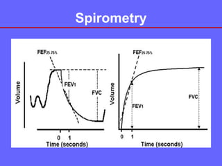 Spirometry

 