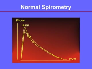 Normal Spirometry

 