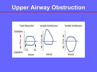 Upper Airway Obstruction

 