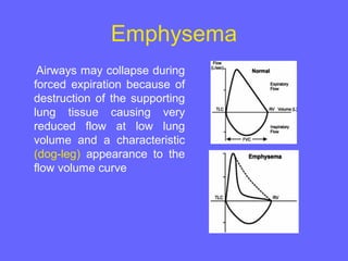 Emphysema
Airways may collapse during
forced expiration because of
destruction of the supporting
lung tissue causing very
reduced flow at low lung
volume and a characteristic
(dog-leg) appearance to the
flow volume curve

 