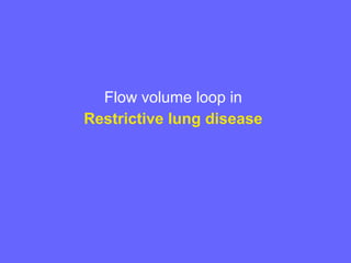 Flow volume loop in
Restrictive lung disease

 