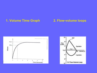 1. Volume Time Graph

2. Flow-volume loops

 