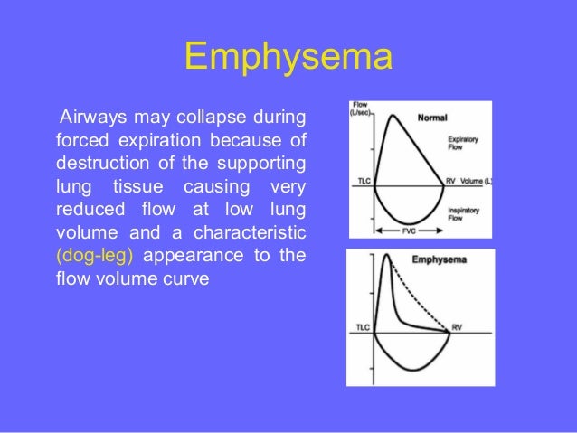 Pulmonary function testing