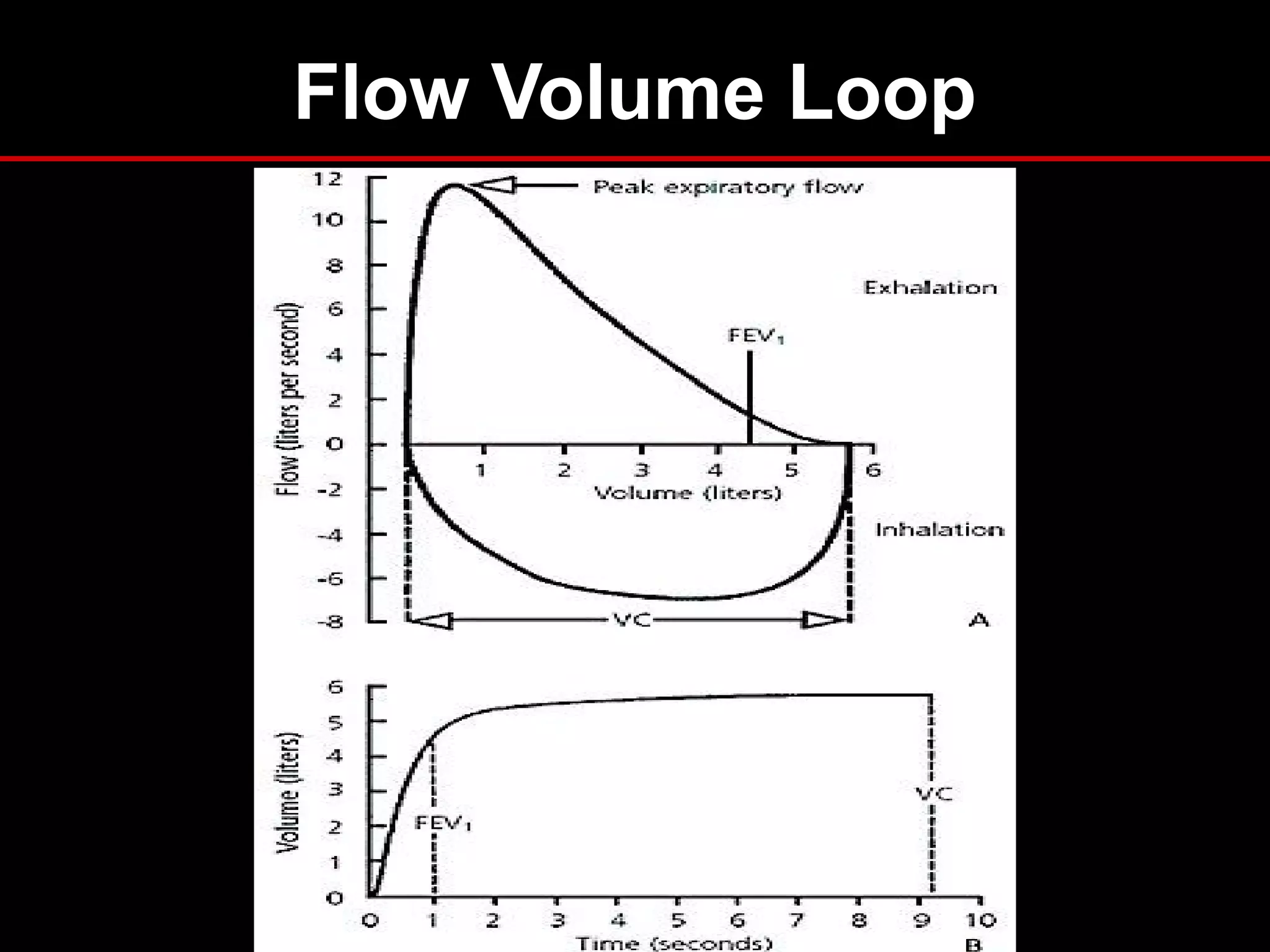 Flow Volume Loop
 