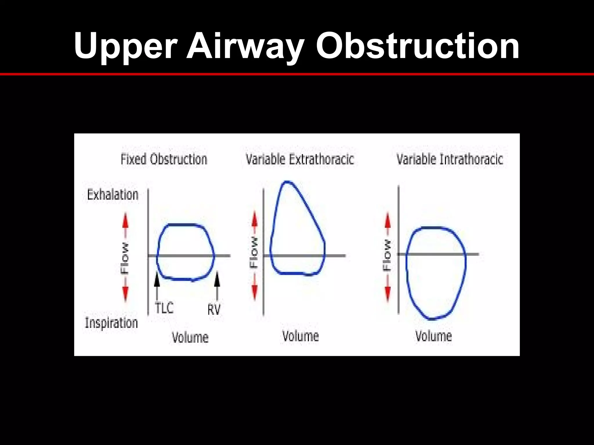 Upper Airway Obstruction
 