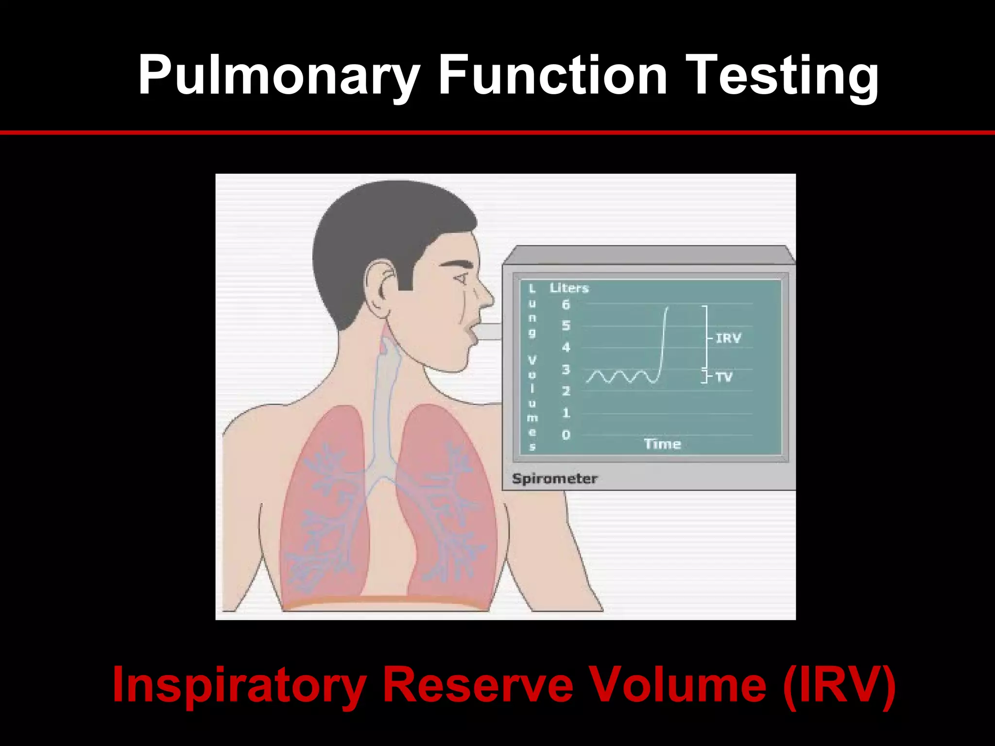 Pulmonary Function Testing
Inspiratory Reserve Volume (IRV)
 