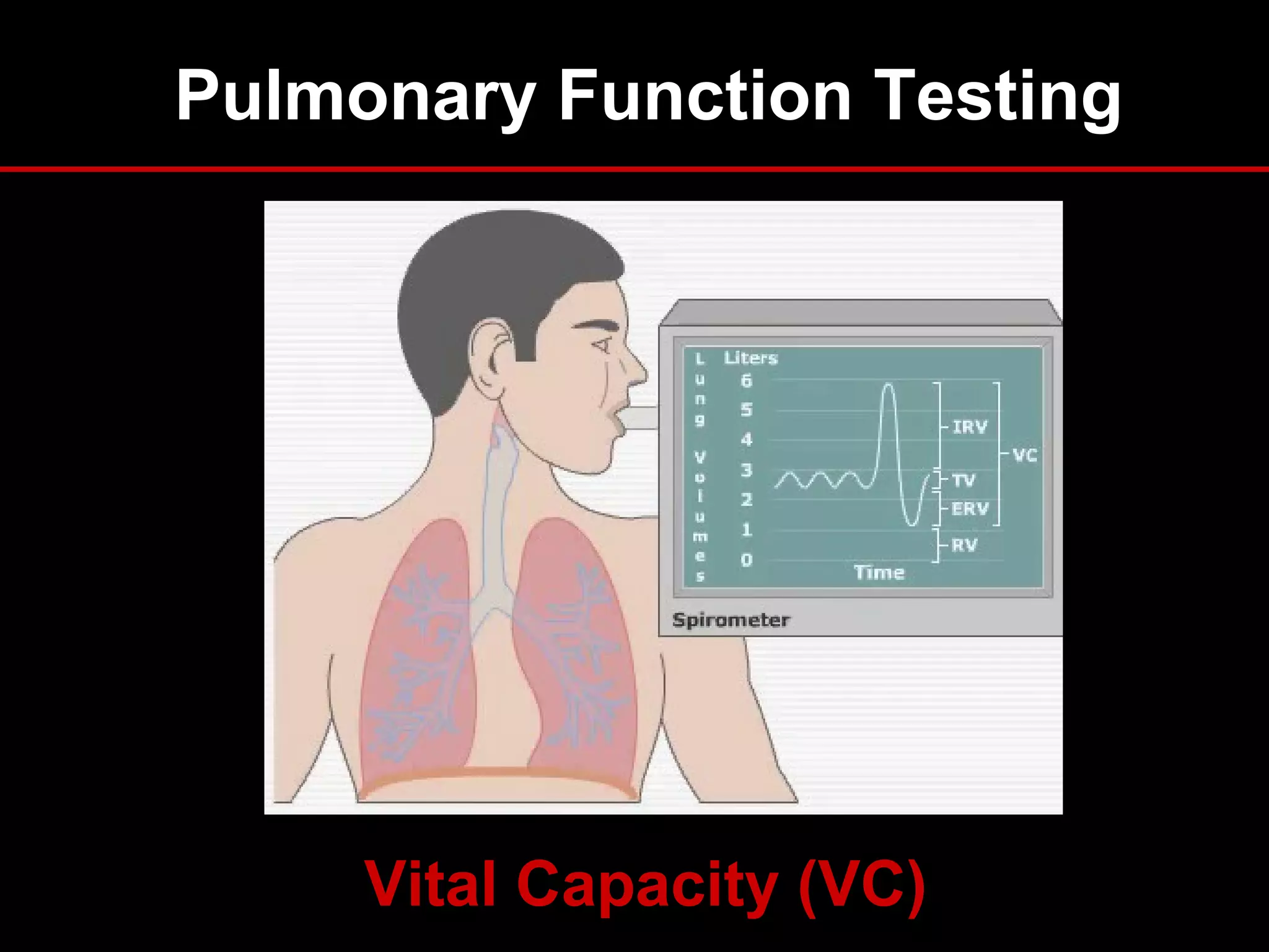 Pulmonary Function Testing
Vital Capacity (VC)
 