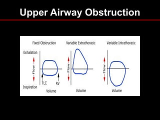Pulmonary Function Testing | PPT