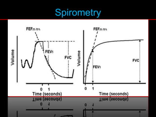 Spirometry
 