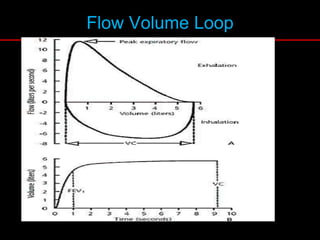 Flow Volume Loop
 