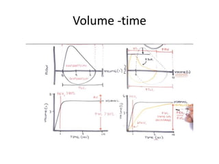 Volume -time
 