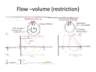 Flow –volume (restriction)
 