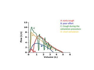 A: early cough
B: poor effort
C: Cough during the
exhalation procedure
D: short exhalation
 